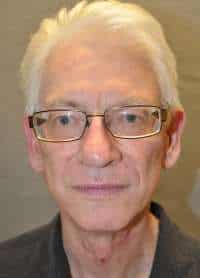 Male Facelift