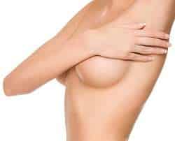 breast augmentation model