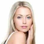 acne scars model